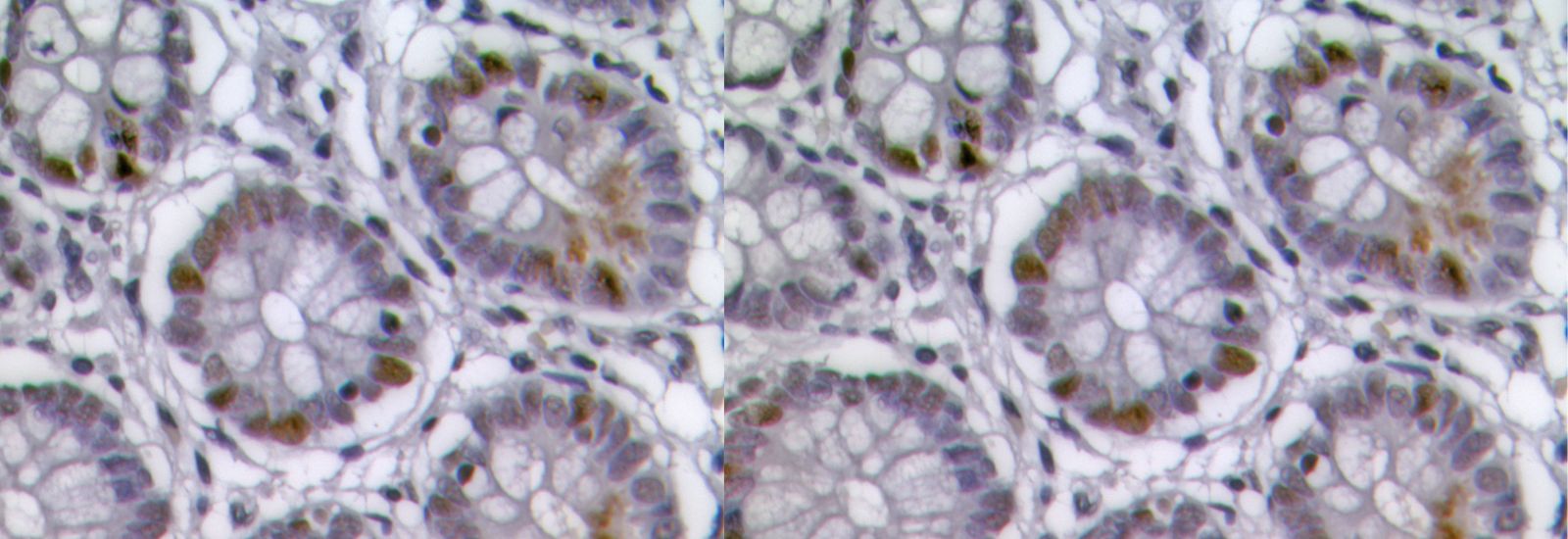 Fundamental Discovery